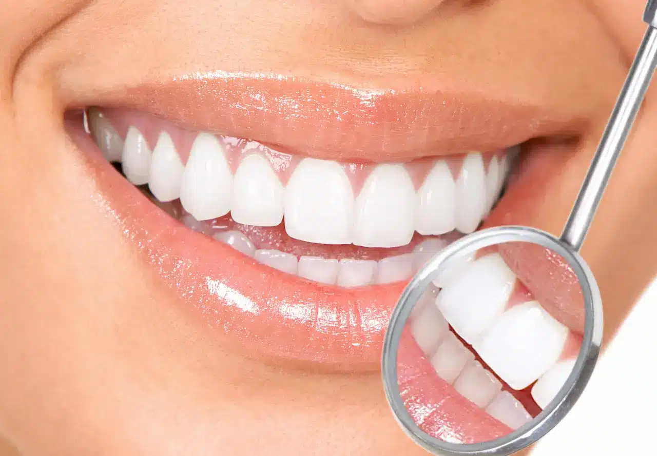 Woman's White Teeth And Dentist Mouth Mirror