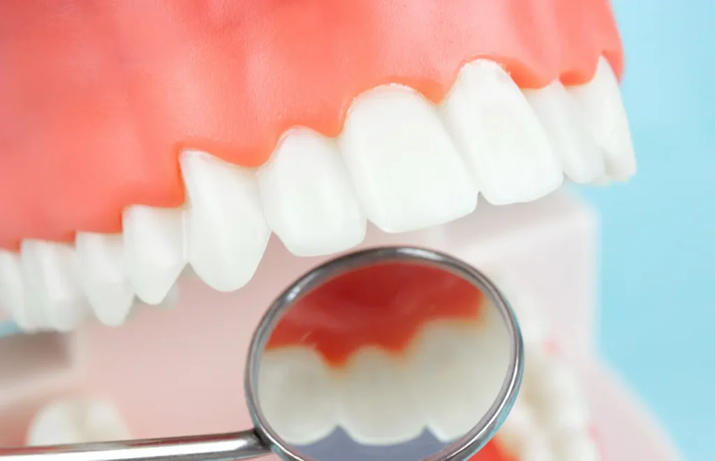 Why Regular Dental Checkups Are So Important