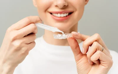 What is Tooth Whitening?
