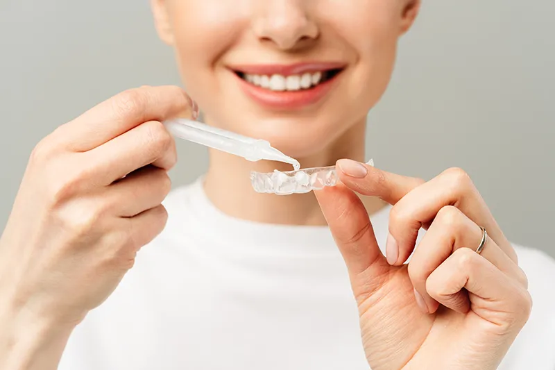 Tooth Whitening