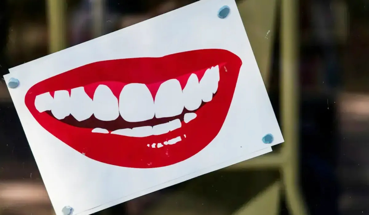 White Teeth White Teeth