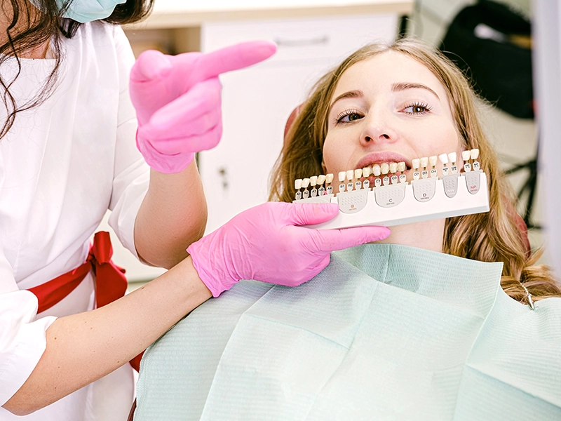 Alma-Dental-Surgery-Dental-Veneers-dental-visit Dental Veneers