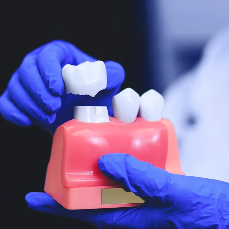 Dental crowns