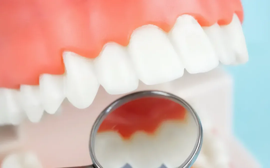 dental check-up
