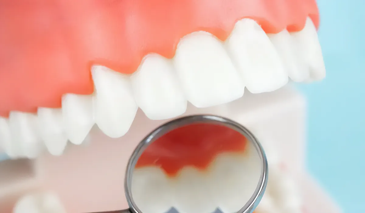 dental check-up