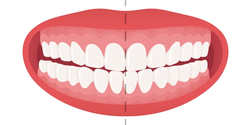 cross bite cross bite