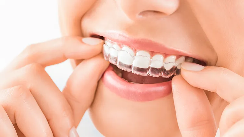 Orthodontics Orthodontics
