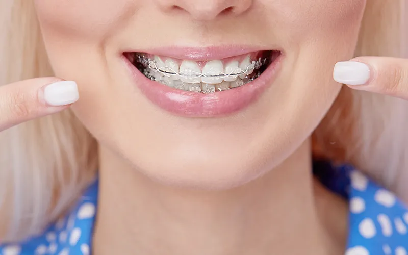 orthodontic treatment orthodontic treatment
