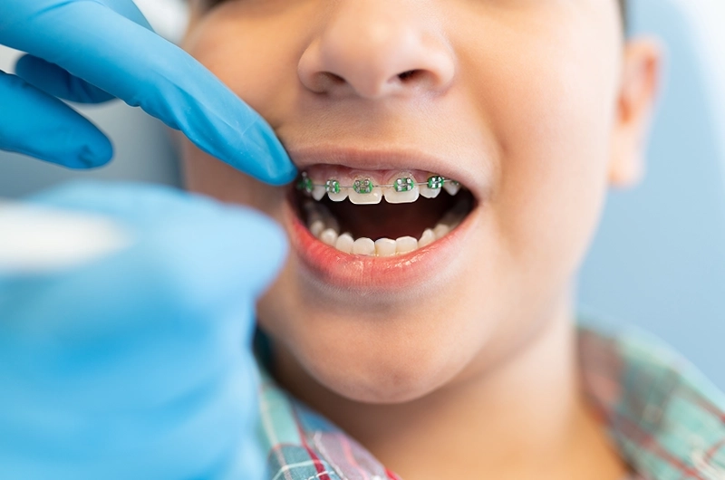 Orthodontics for Children & Teenagers