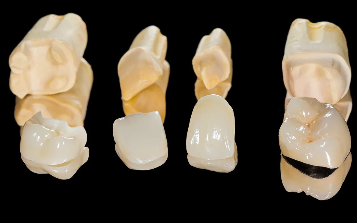 dental crown dental crown