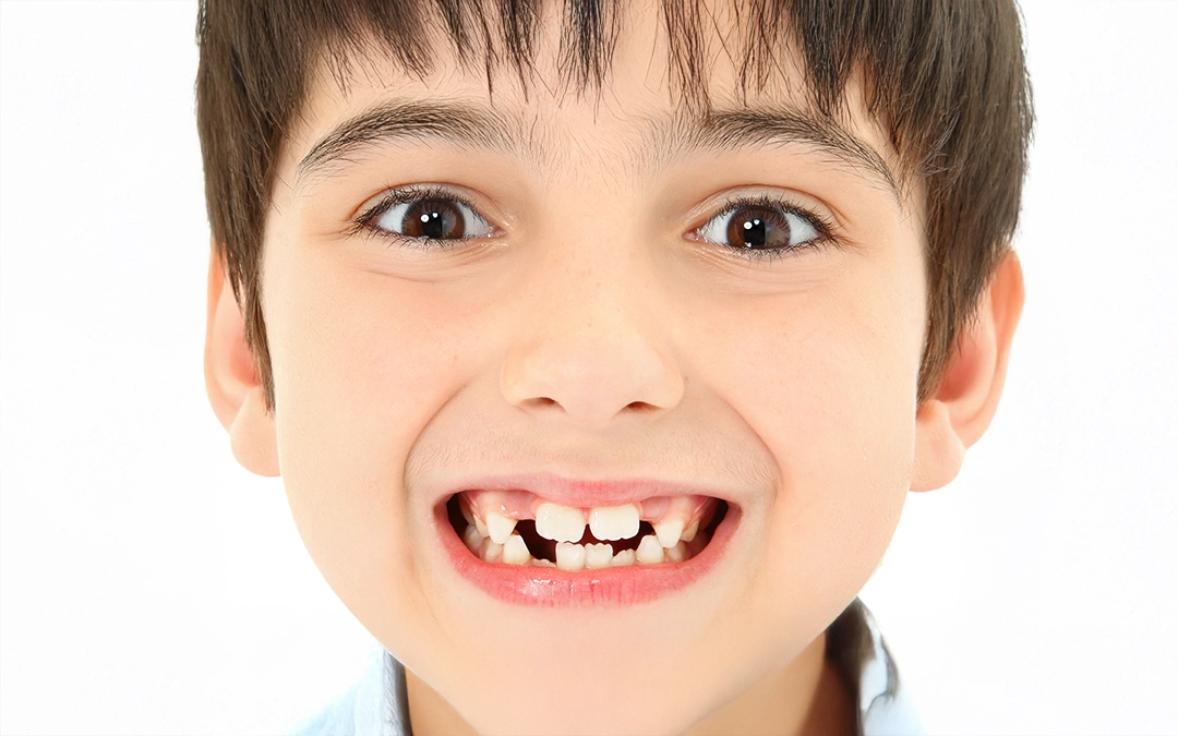 early tooth loss