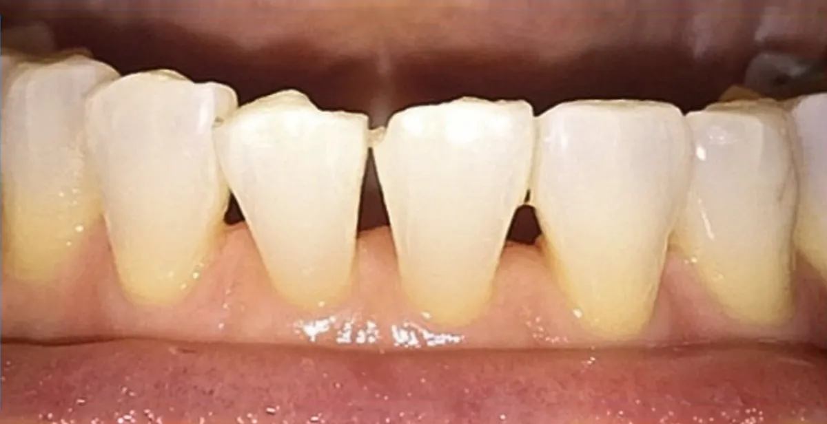 Before dental treatment