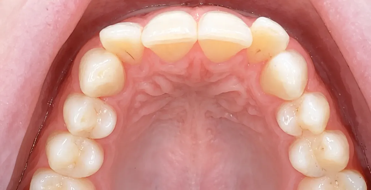 Before dental treatment