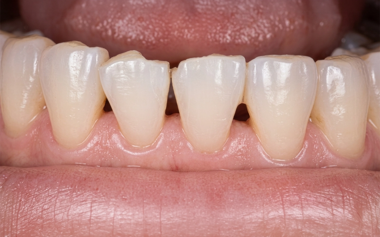 Before dental treatment