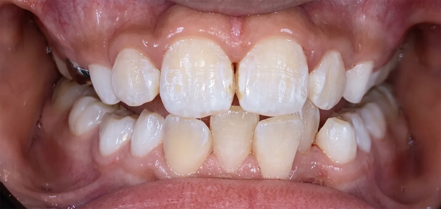 Before Image