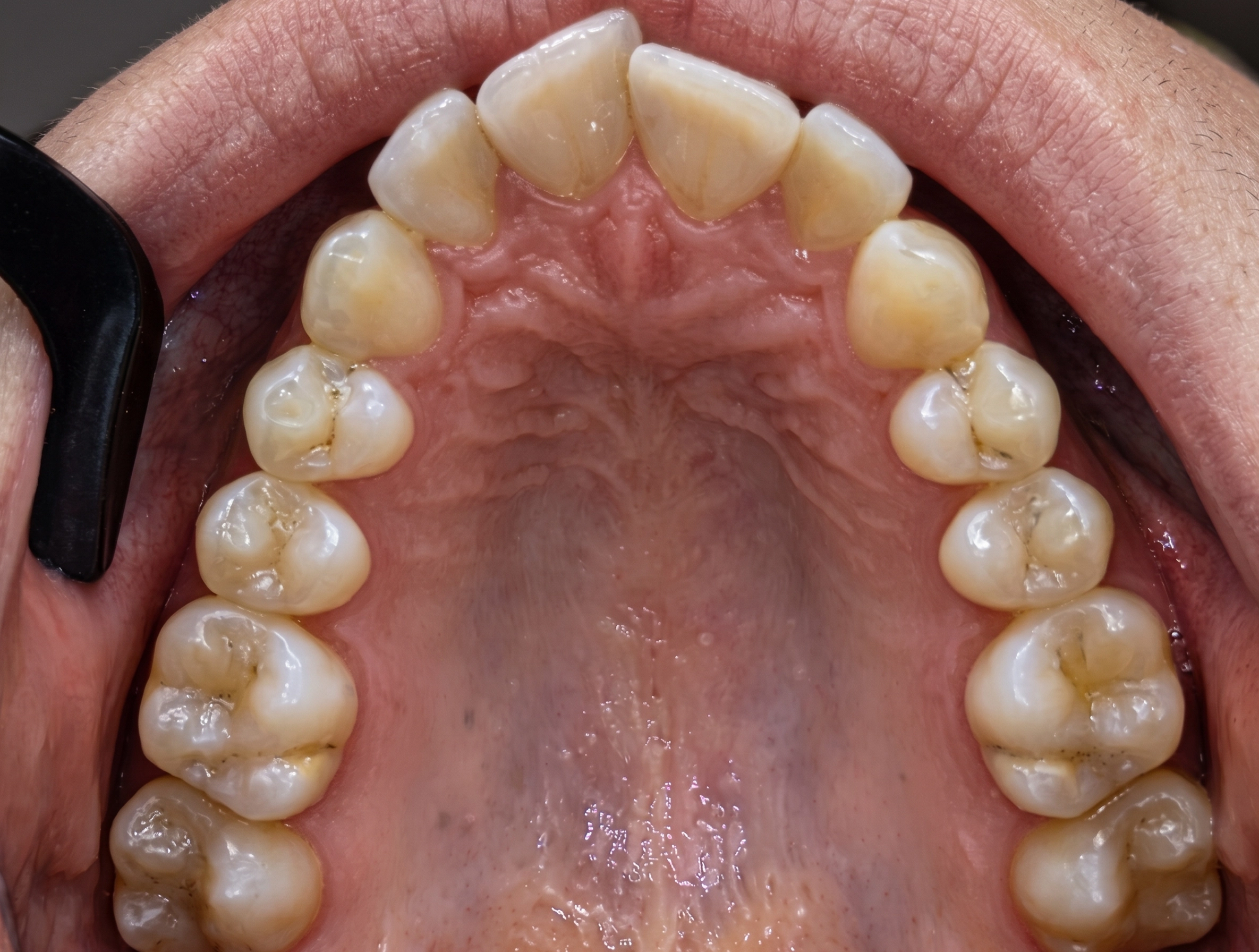 Before Image