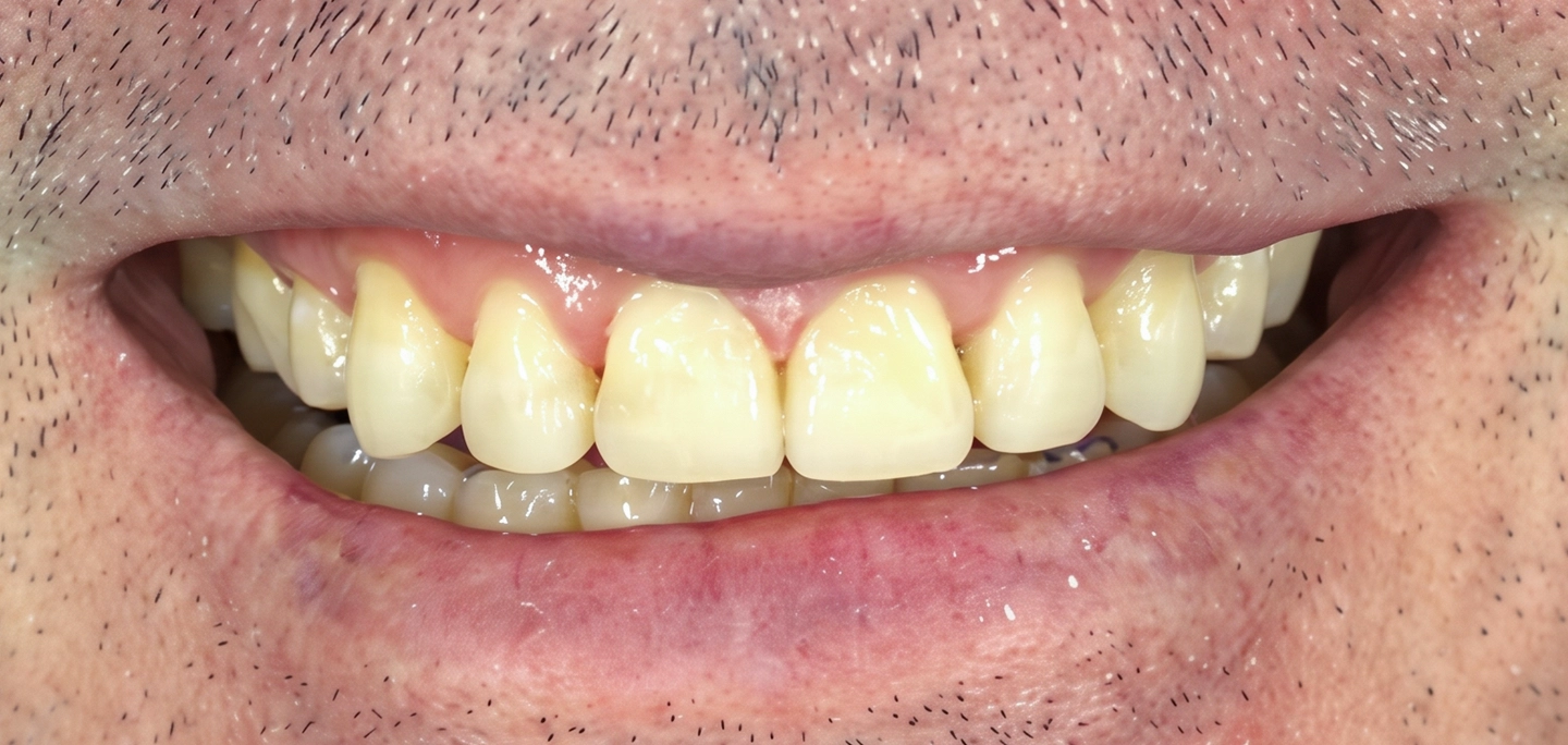 After Image