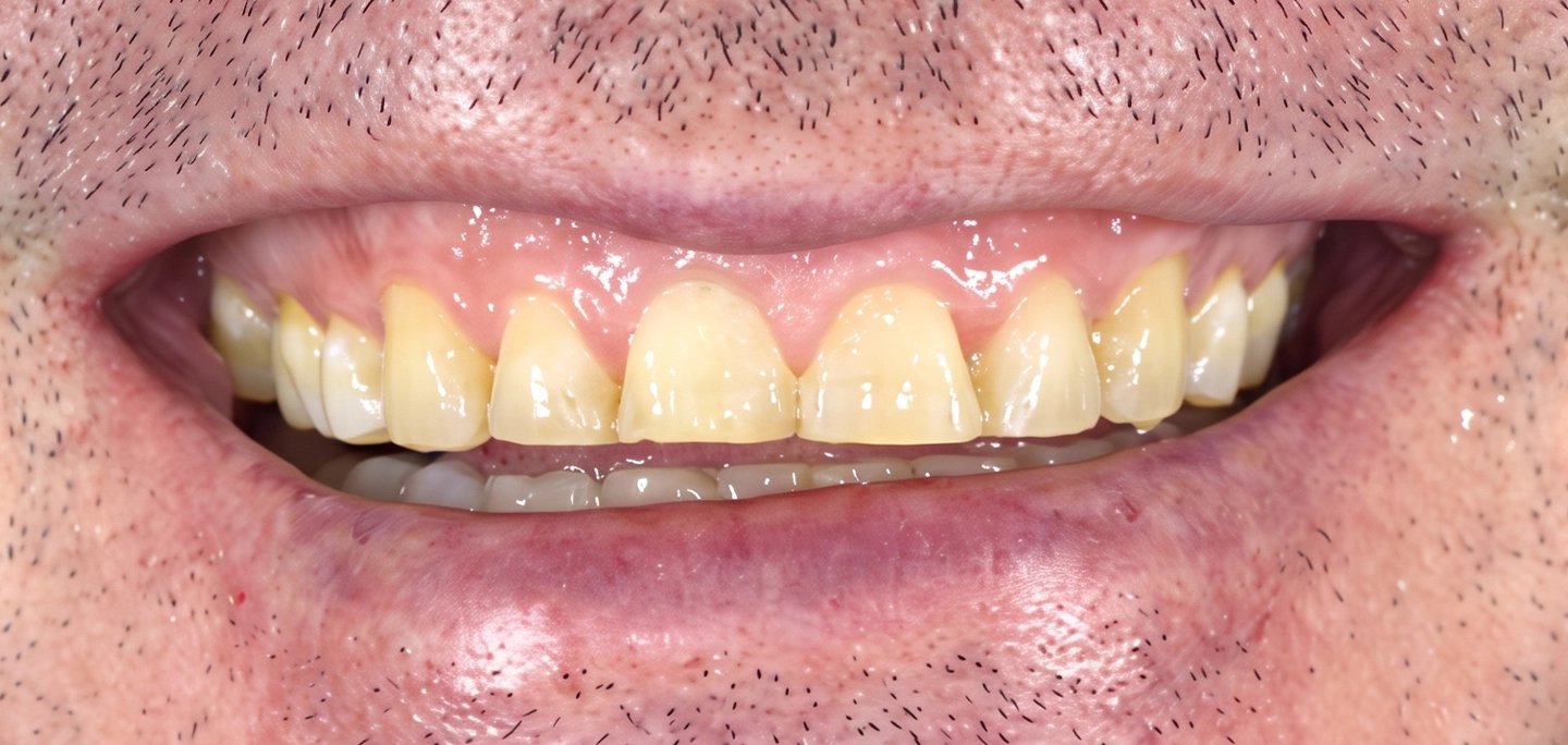 Before Image