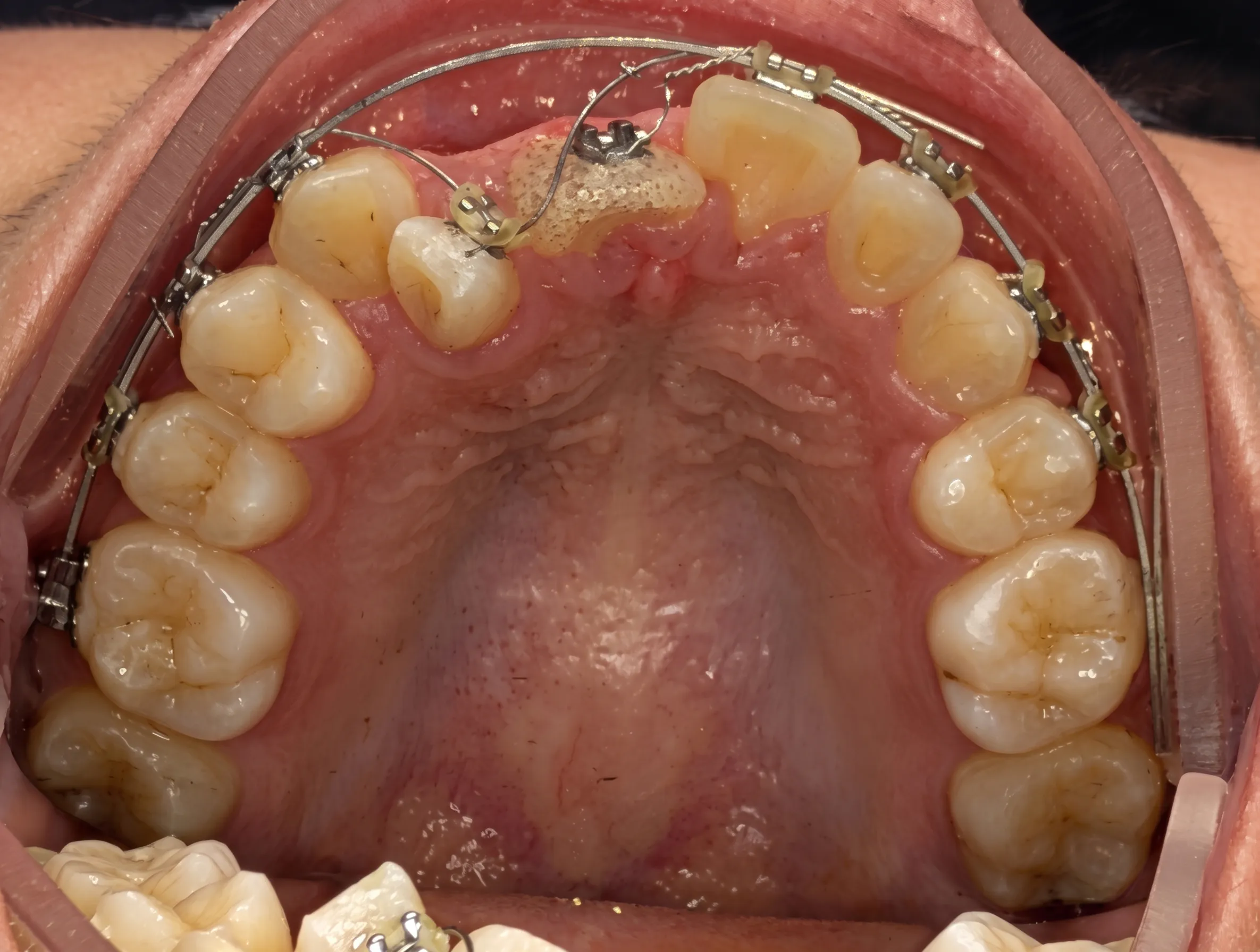 Before Image