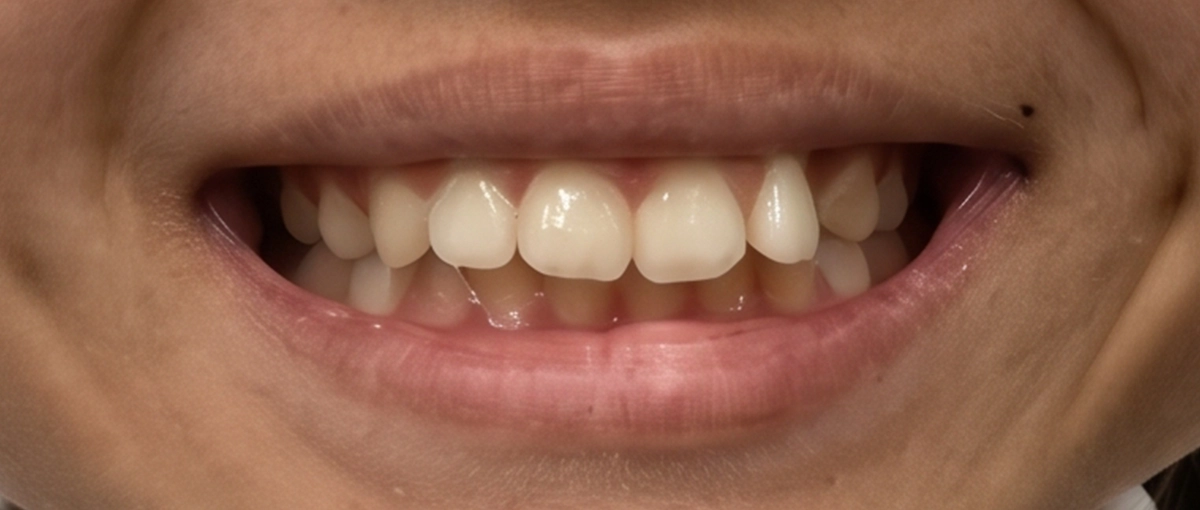 Case Study: Teen Orthodontic Treatment